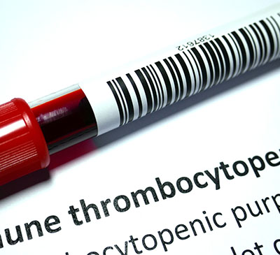 Global Immune Thrombocytopenia Drugs Market 2019-2023